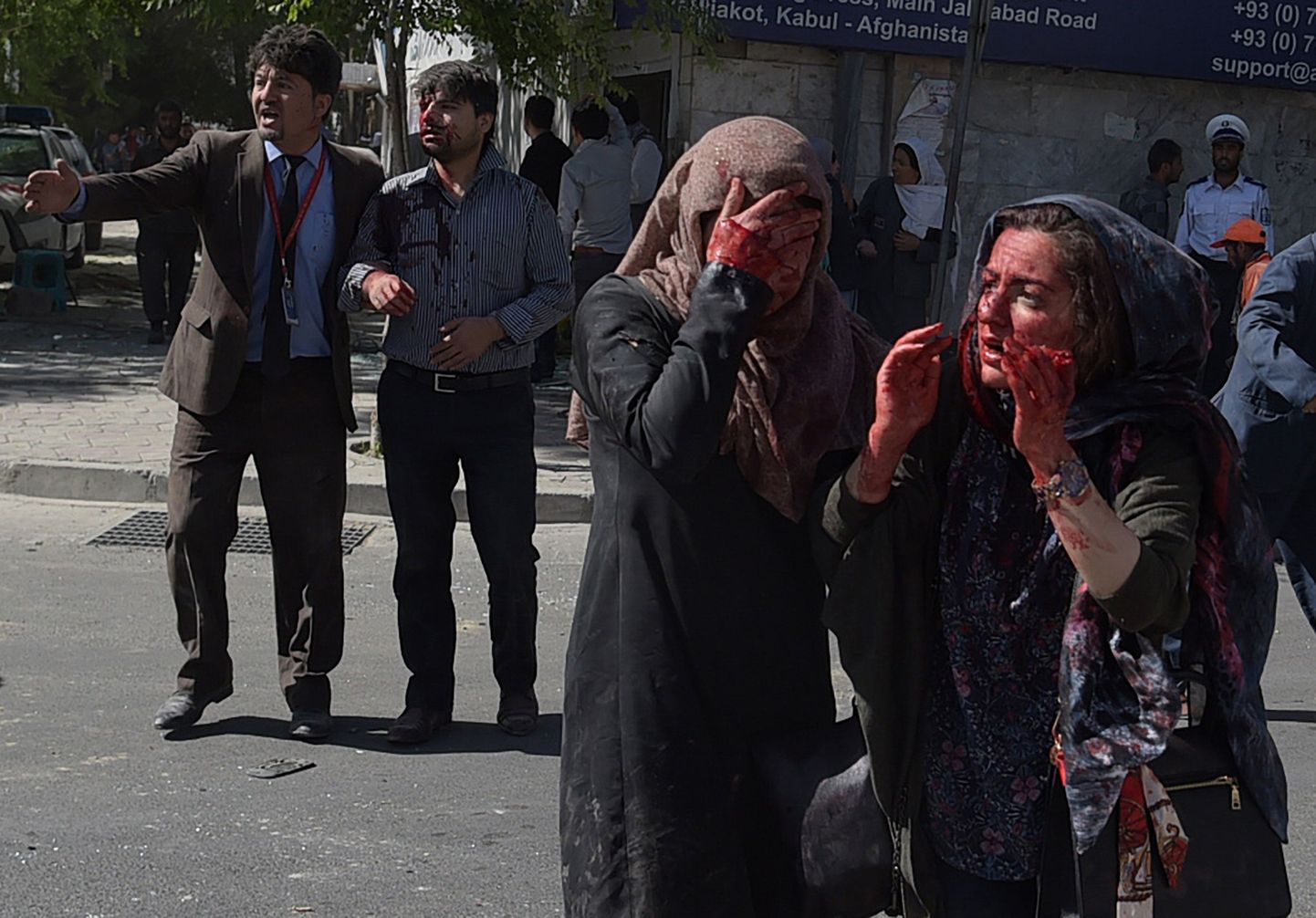 31 мая в Кабуле произошел мощный взрыв, унесший жизнь почти ста человек.