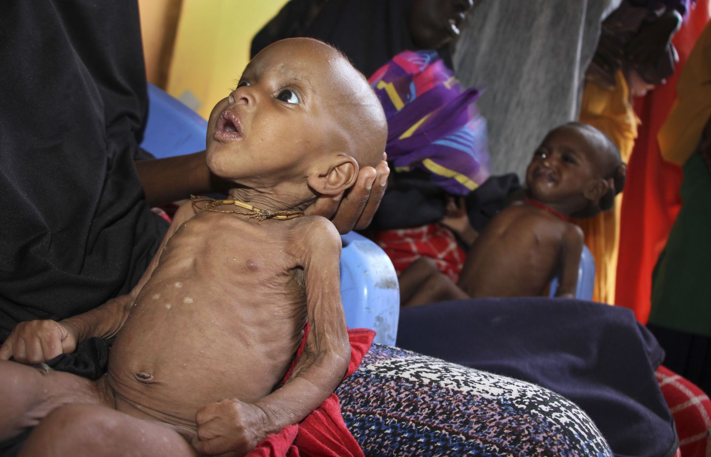 9-kuune näljas ja veepuuduses laps oma ema süles Mogadishus, Somalia.