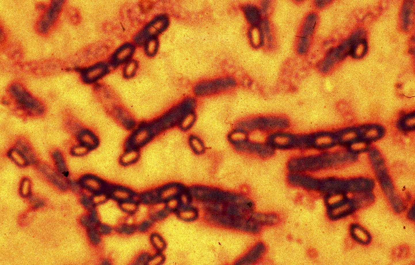 Siberi katku põhjustavad Bacillus anthracis bakterid
