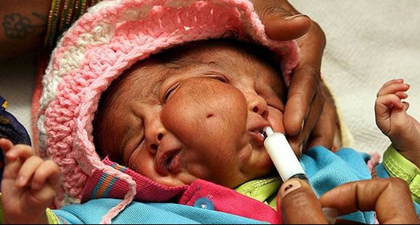 Indias sündis kahe näoga laps