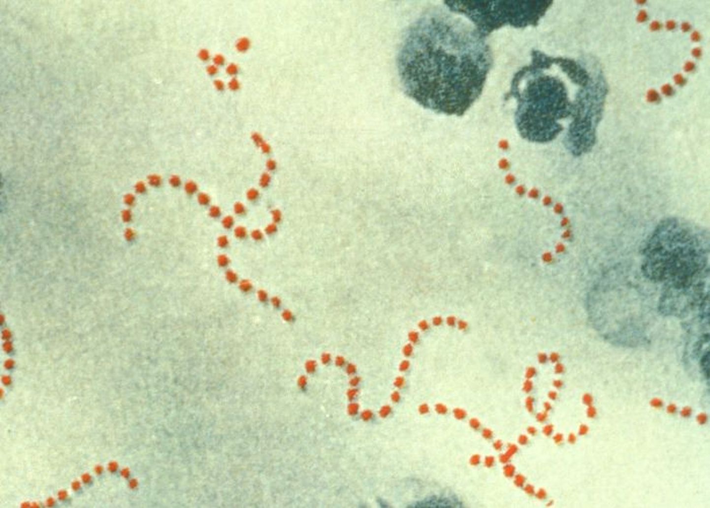 Streptococcus pyogenes on teatud tingimustel tuntud ka kui lihasööja streptokokk ehk lihasööjabakter.