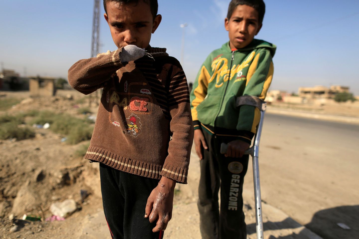 Sõjategevuses haavata saanud lased Iraagis.