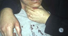 Фото: полиция задержала подозреваемого в нападении на ночной клуб в Стамбуле