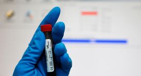 Tulevase olümpiaküla testilabor sattus reeglitega pahuksisse