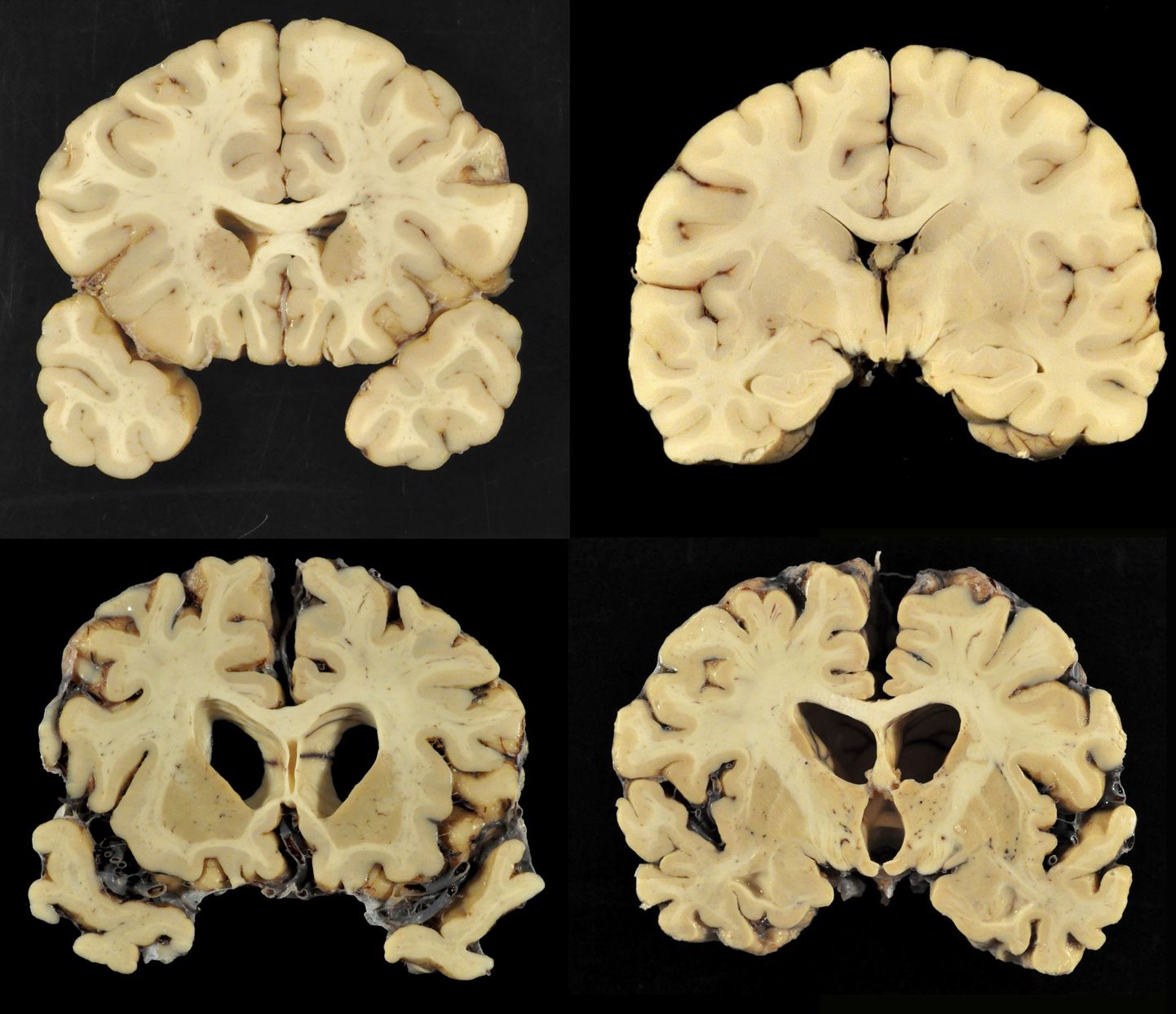 Bostoni ülikooli uuringutel kasutatavad ajud