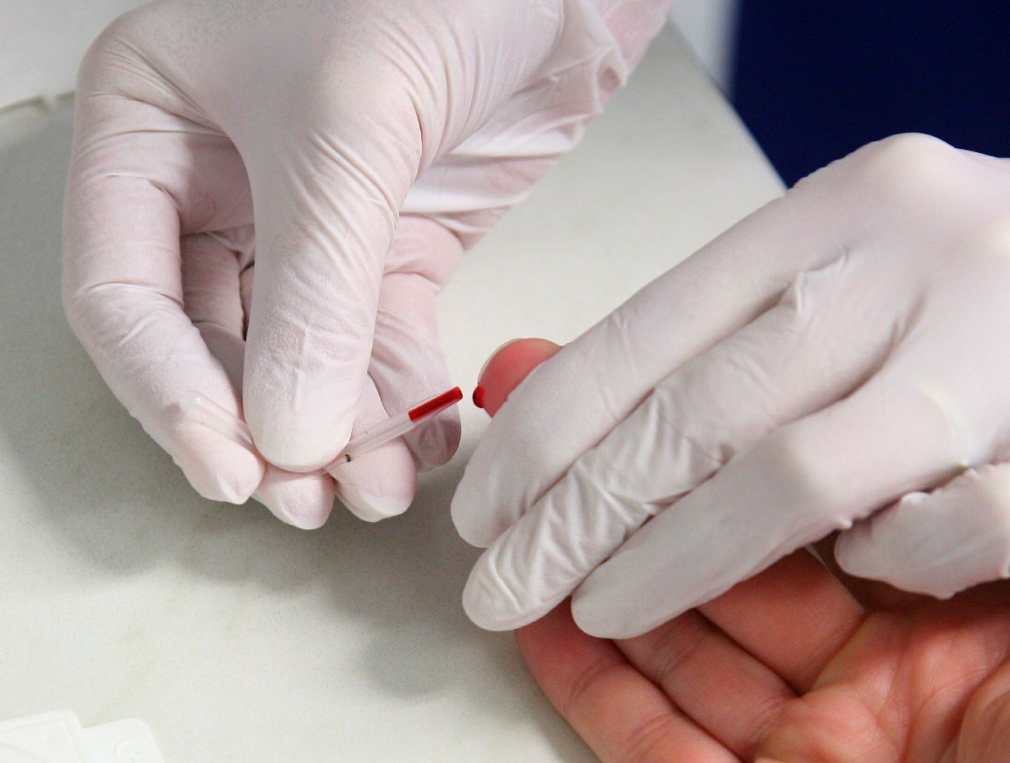 Kiireim viis HIV avastada on teha kiirtest.