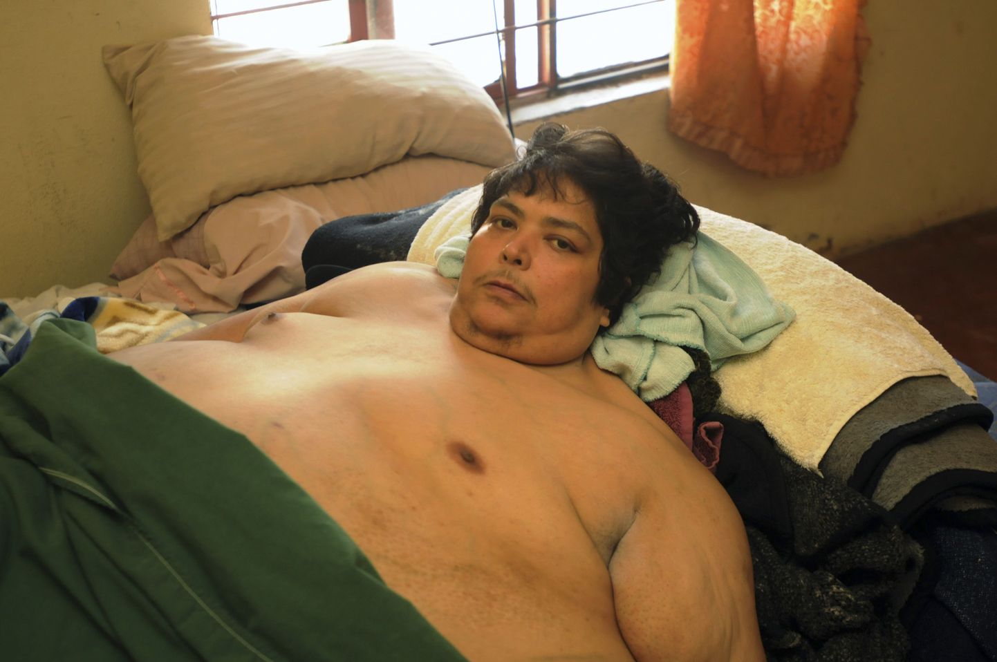 450 kilogrammi kaalunud 47-aastane mehhiklane Jose Luis Garza