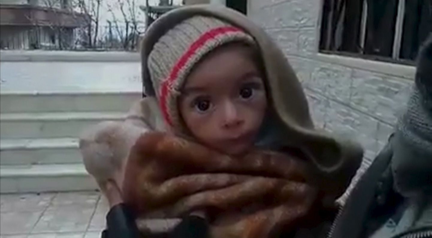 Sotsiaalmeedias leviv pilt Madaya nälgivast lapsest