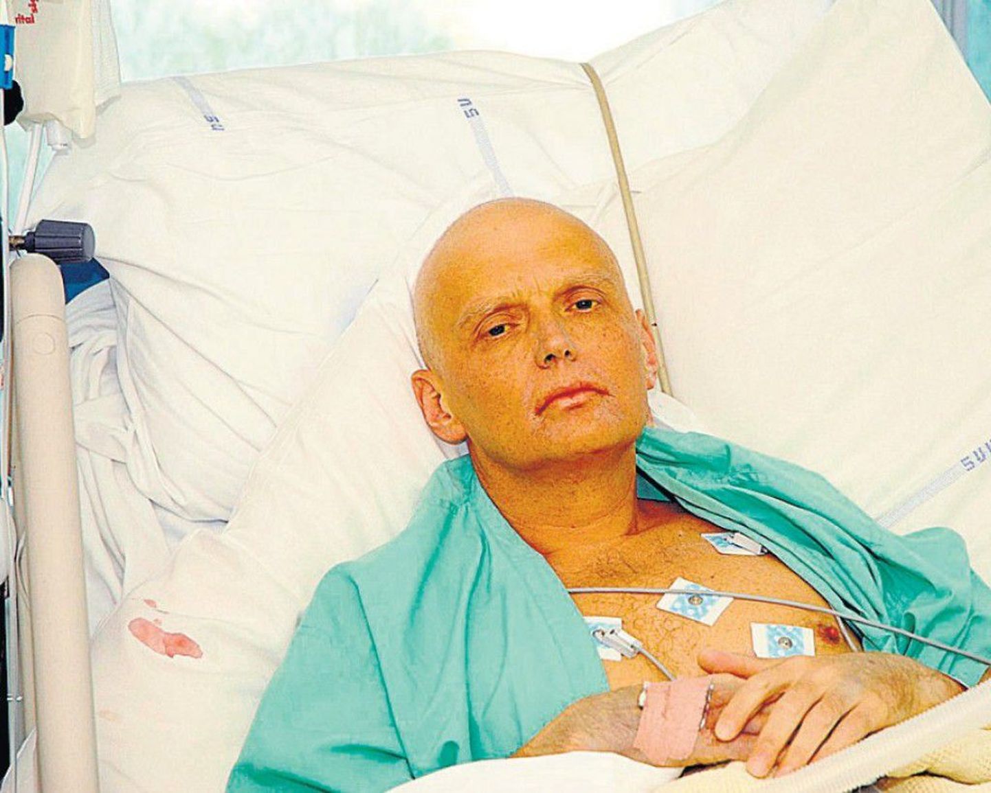 Polooniumimürgitusse surnud Aleksandr Litvinenko haiglas.