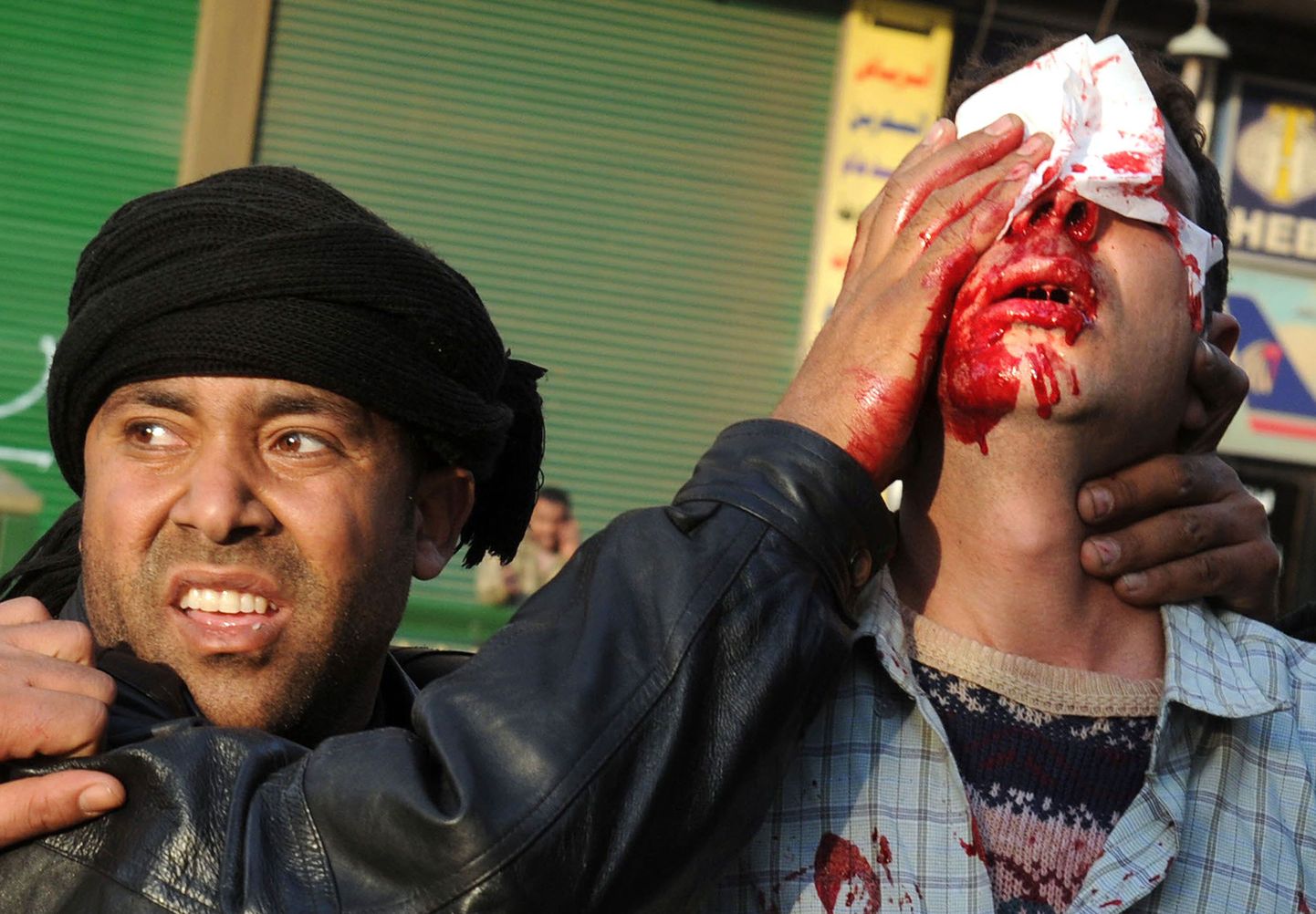 Kairo Tahriri väljakul vigastada saanu