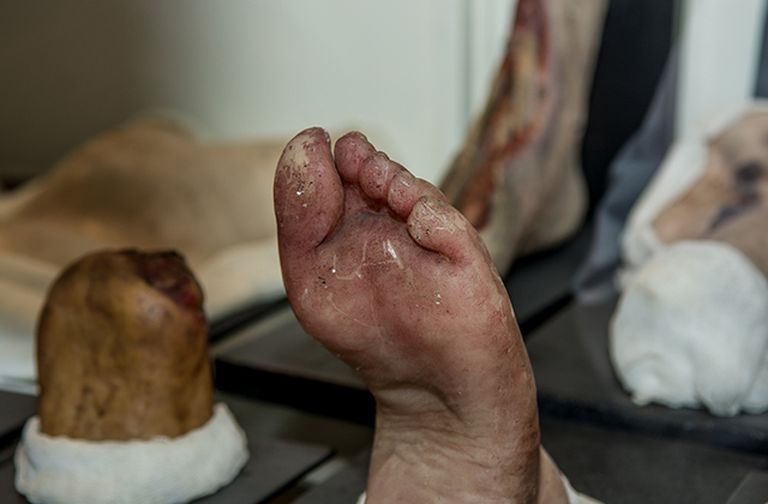 Muzejā var apskatīt gan veselus orgānus, gan tādus, kurus piemeklējušas dažādas saslimšanas un pataloģijas. Tāpat te var redzēt pēc nelaimes gadījumiem iegūtas ķermeņa daļas, piemēram, tīģera norautu roku, avārijā norautu kāju