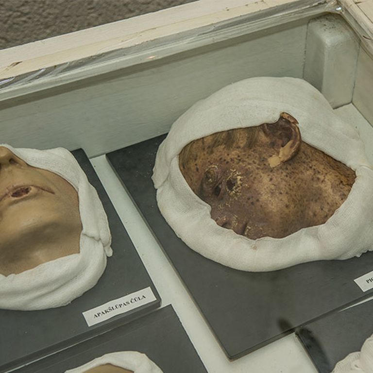 Muzejā izvietoti gan mirušu cilvēku daļas, gan dažādas mulāžas no vaska un plastmasas 