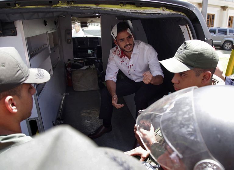 Opositsioonisaadik Armando Armas eile pärast rünnakut. Foto: AFP PHOTO / Francisco BRUZCO Scanpix/ 