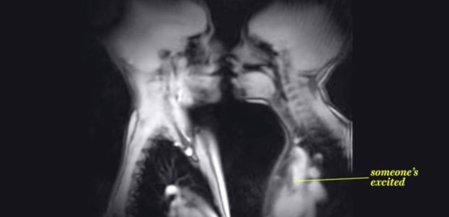 MRI skaneering suudlejatest