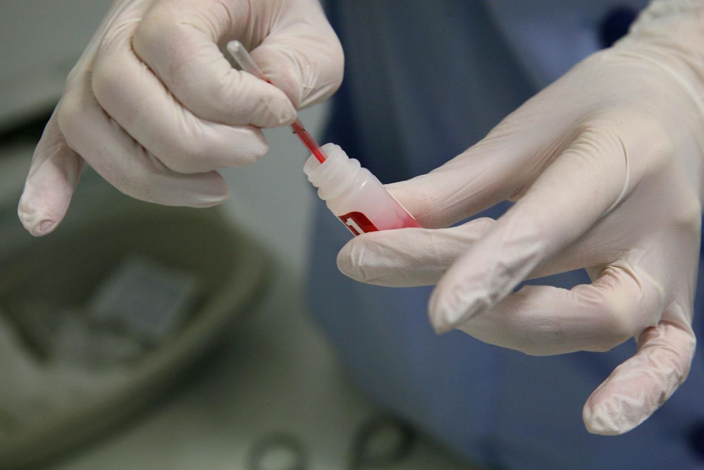 HIV-i kiirtesti komplekt. Pildil vere lisamine testlahusesse.