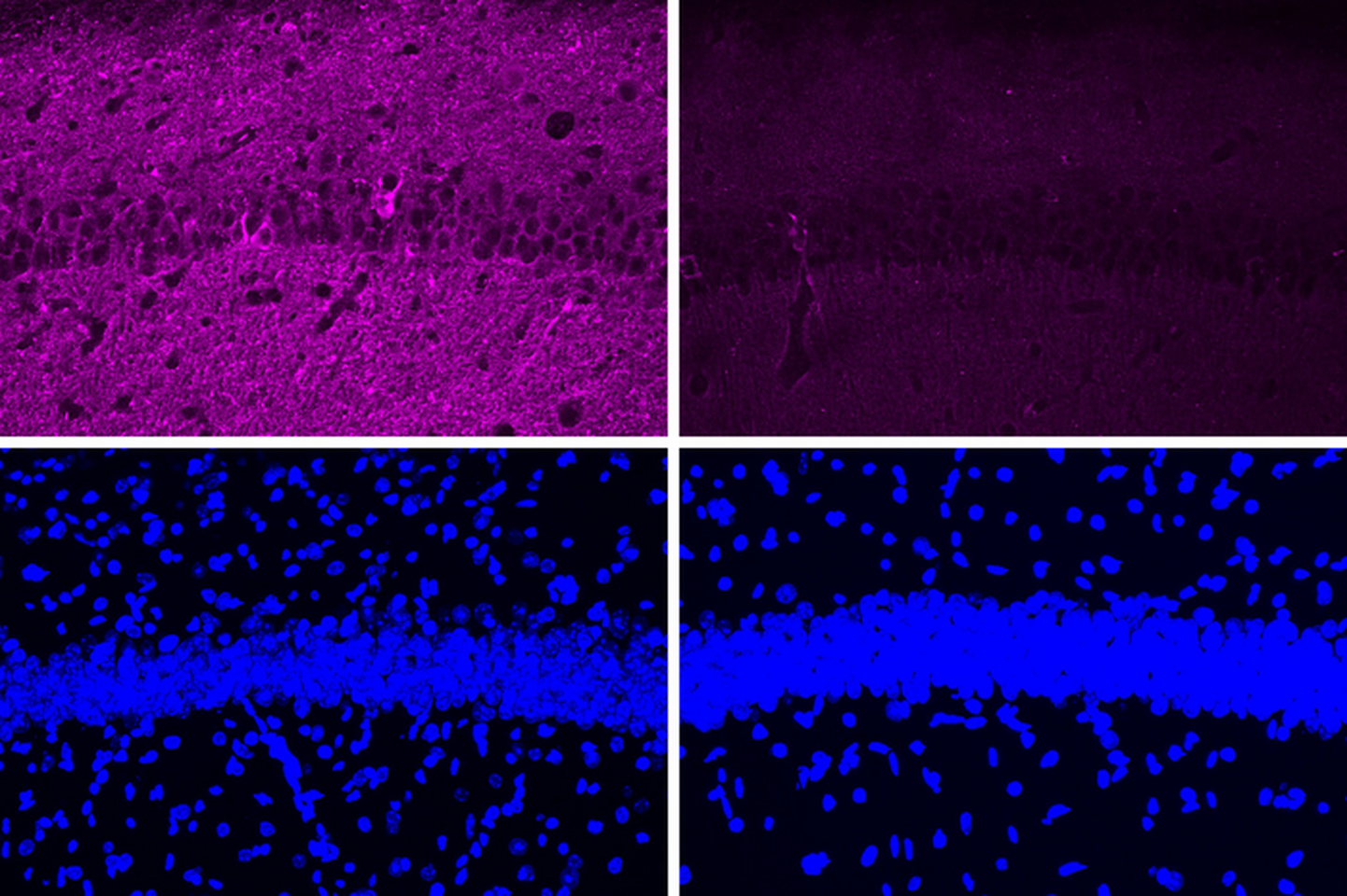 Uue peptiidiga töödeldud hiirte ajus (kaks parempoolset paneeli) on näha palju vähem Tau valke (värvitud lillaks). Vasakpoolsed paneelid näitavad haigusttekitavate peptiidiga töödeldud hiirte neuroneid. Kahel alumisel pildil on DNA raku tuumades värvitud siniseks, mis näitab, et Tau taseme muutused ei ole põhjustatud olulistest muutustest rakupopulatsioonis.