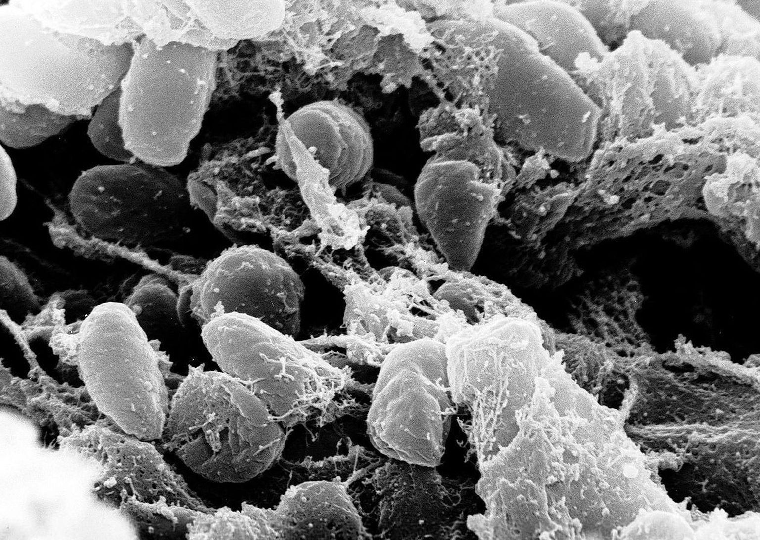 Yersinia pestis bakter mikroskoobi all