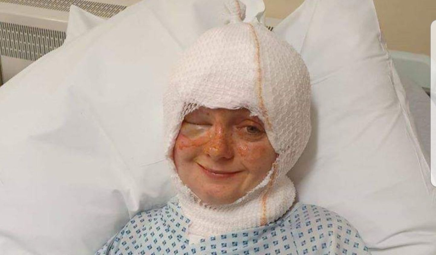 Suurbritanniast pärit Emily läks küünlaleeki kustutama, kuid sattus hoopis haiglasse.
