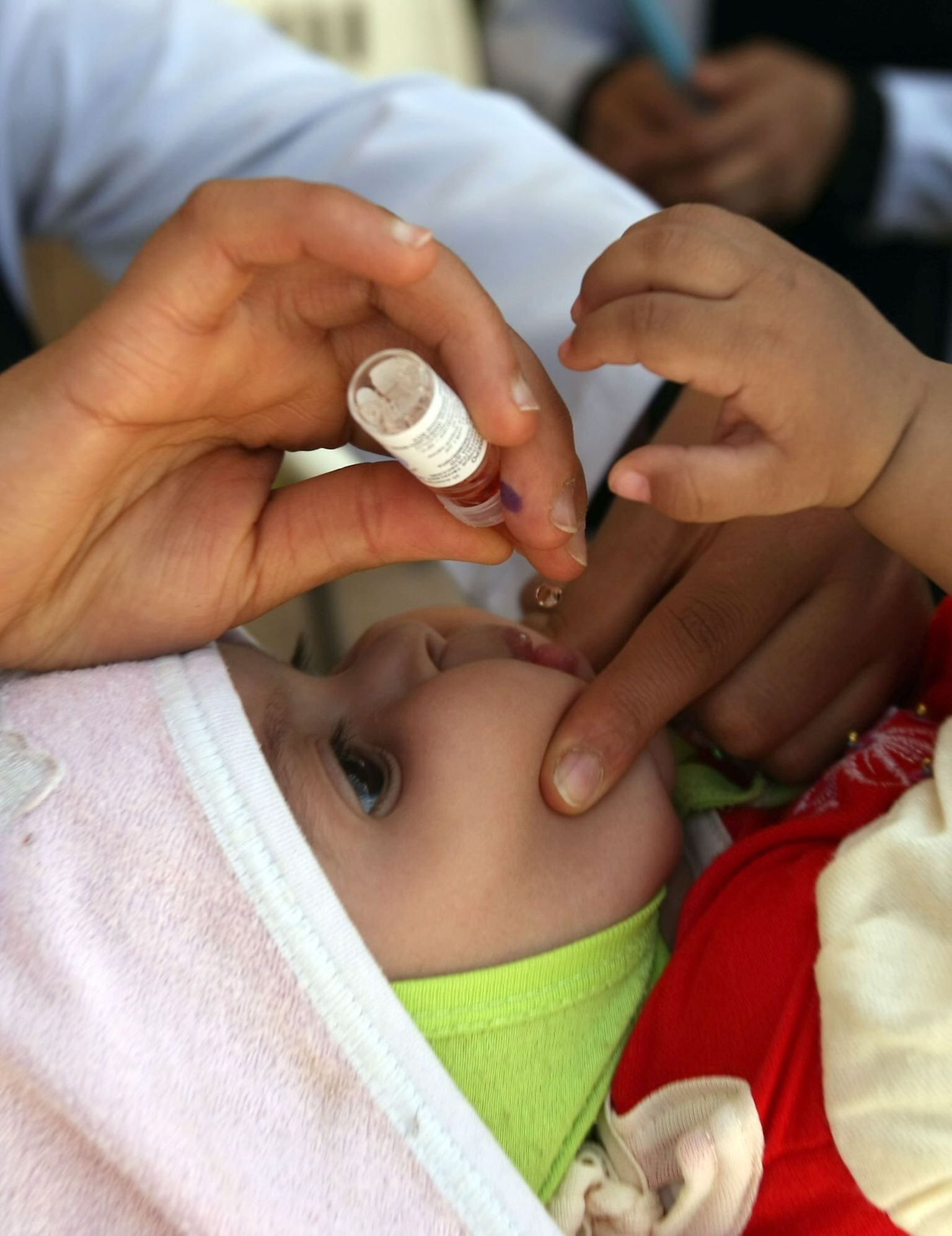 Вакцинация от полиомиелита.