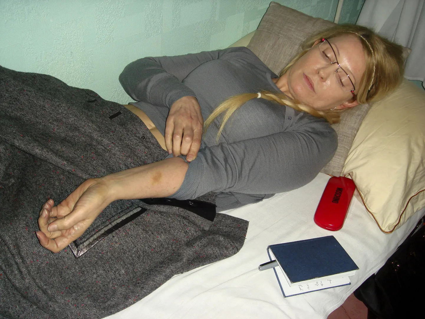 Юлия Тимошенко демонстрирует гематомы