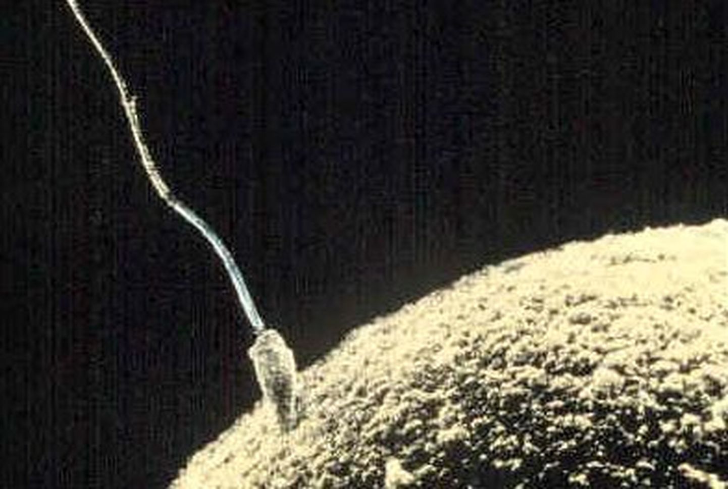 Teadlane: ülikvaliteetne sperma võib olla lastetuse põhjuseks