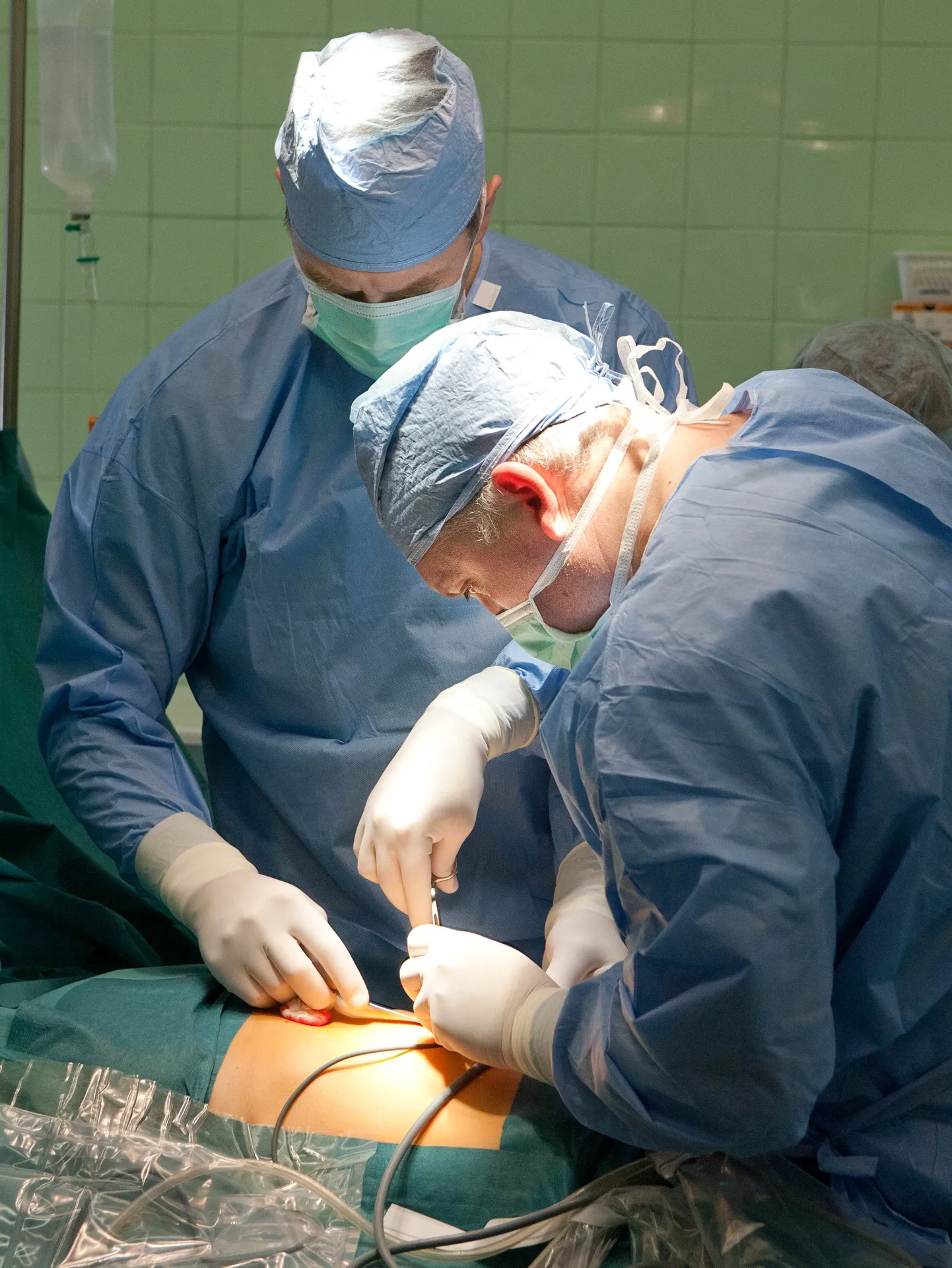 Operatsioon.