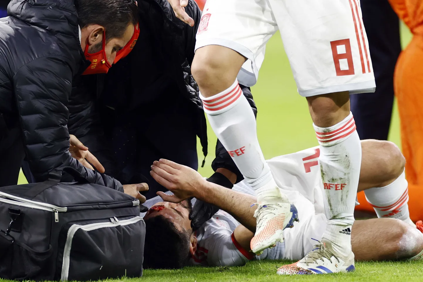 Vigastatud Jose Gaya.