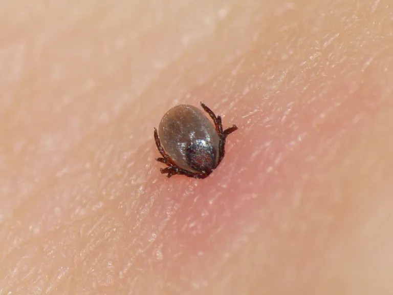 Inimese nahale kinnitunud puuk. Usutavasti peab puuk olema nahale kinnitunud vähemalt 24 tundi, et borrelioosi tekitavad bakterid üle kanduks. Seega on inimestel veidi armuaega pärast loodusest naasmist end üle vaadata.