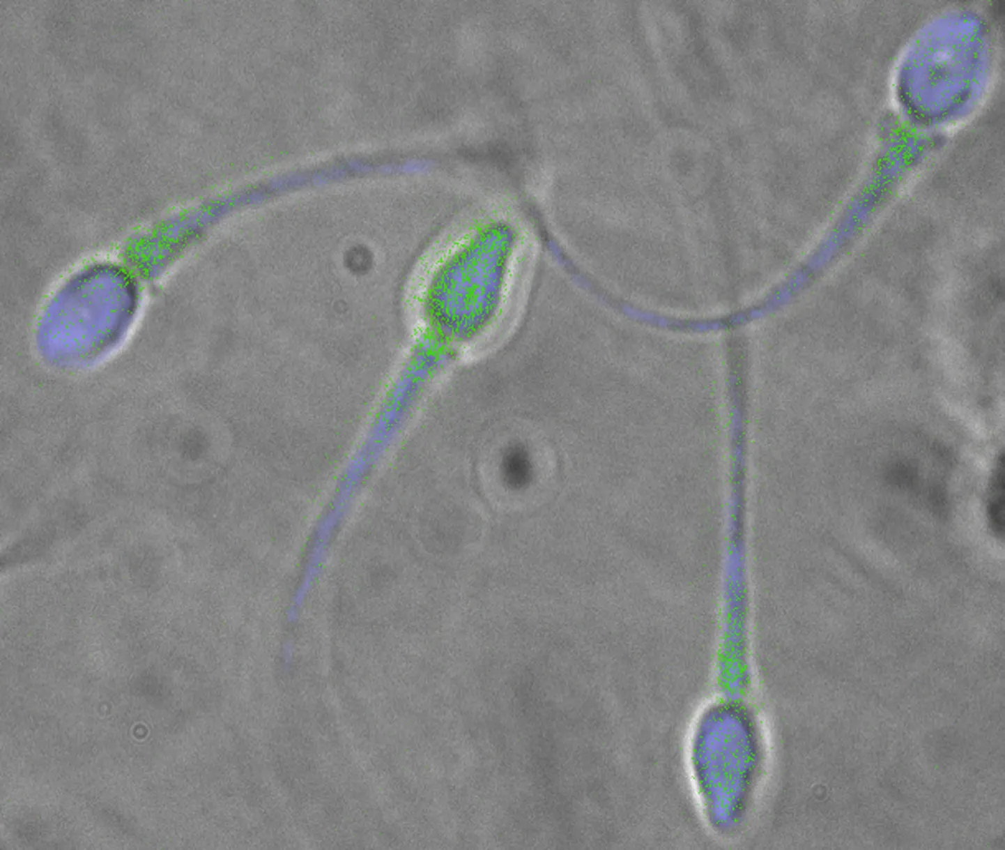 Spermatosoidid elektronmikroskoobi all