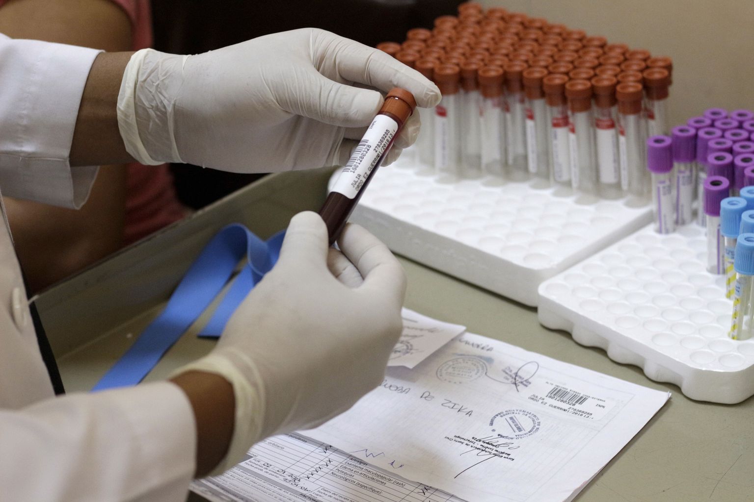 Vereproovid zika viiruse testimise jaoks.