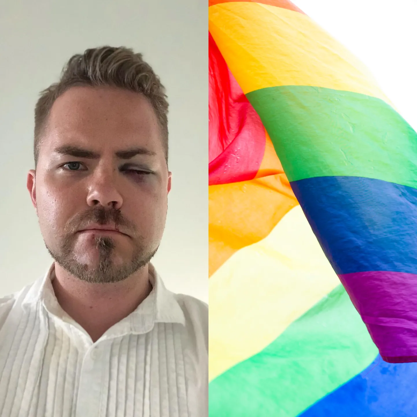 Финский пастор Патрик Тиайнен подвергся нападению в Таллинне, в гей-баре