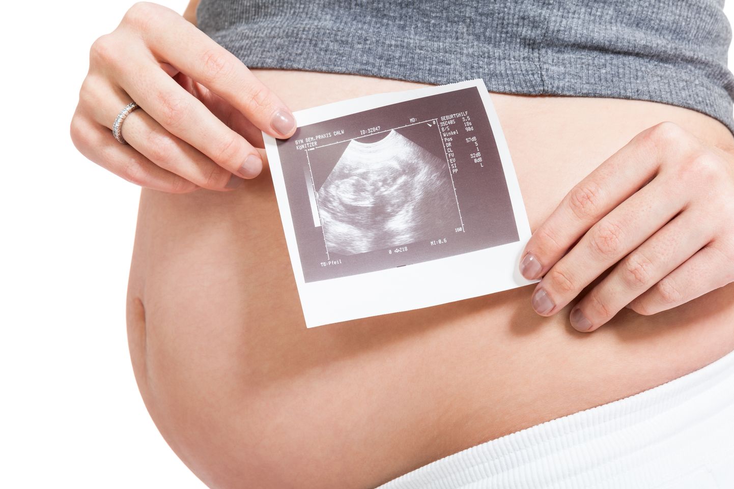 Naise teist rasedust ei avastatud, sest talle ei tehtud ultraheli. Pilt on illustreeriv.