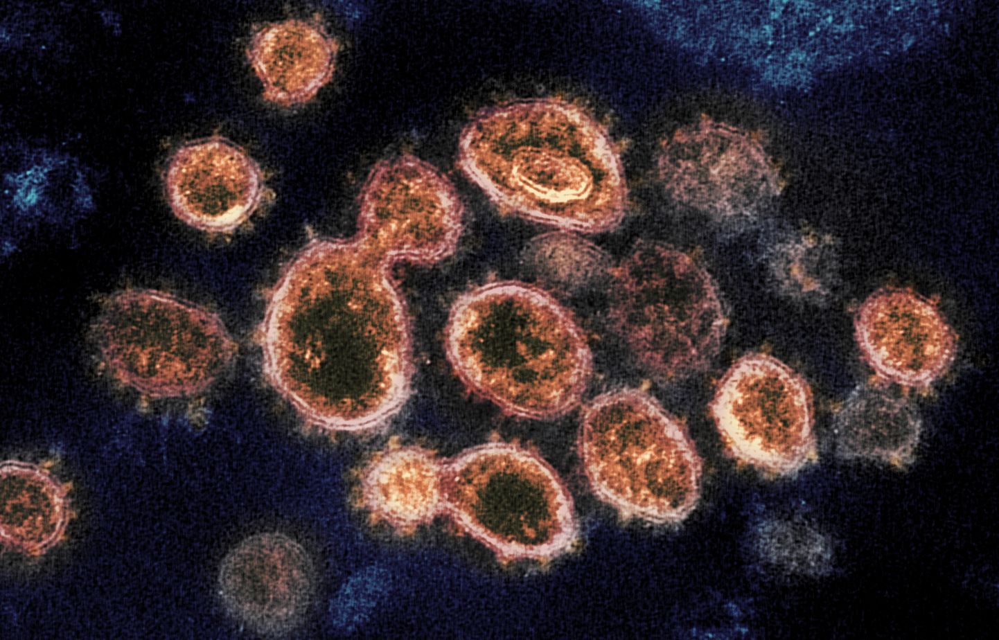 Elektronmikroskoobi pilt Covid-19 haigust põdevalt inimeselt eraldatud SARS-CoV-2 viirusosakestest Rocky Mountain Laboratooriumis USA-s.