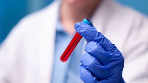 LÄBIMURRE ⟩ Uus vereproov suudab avastada vähi enne sümptomite teket