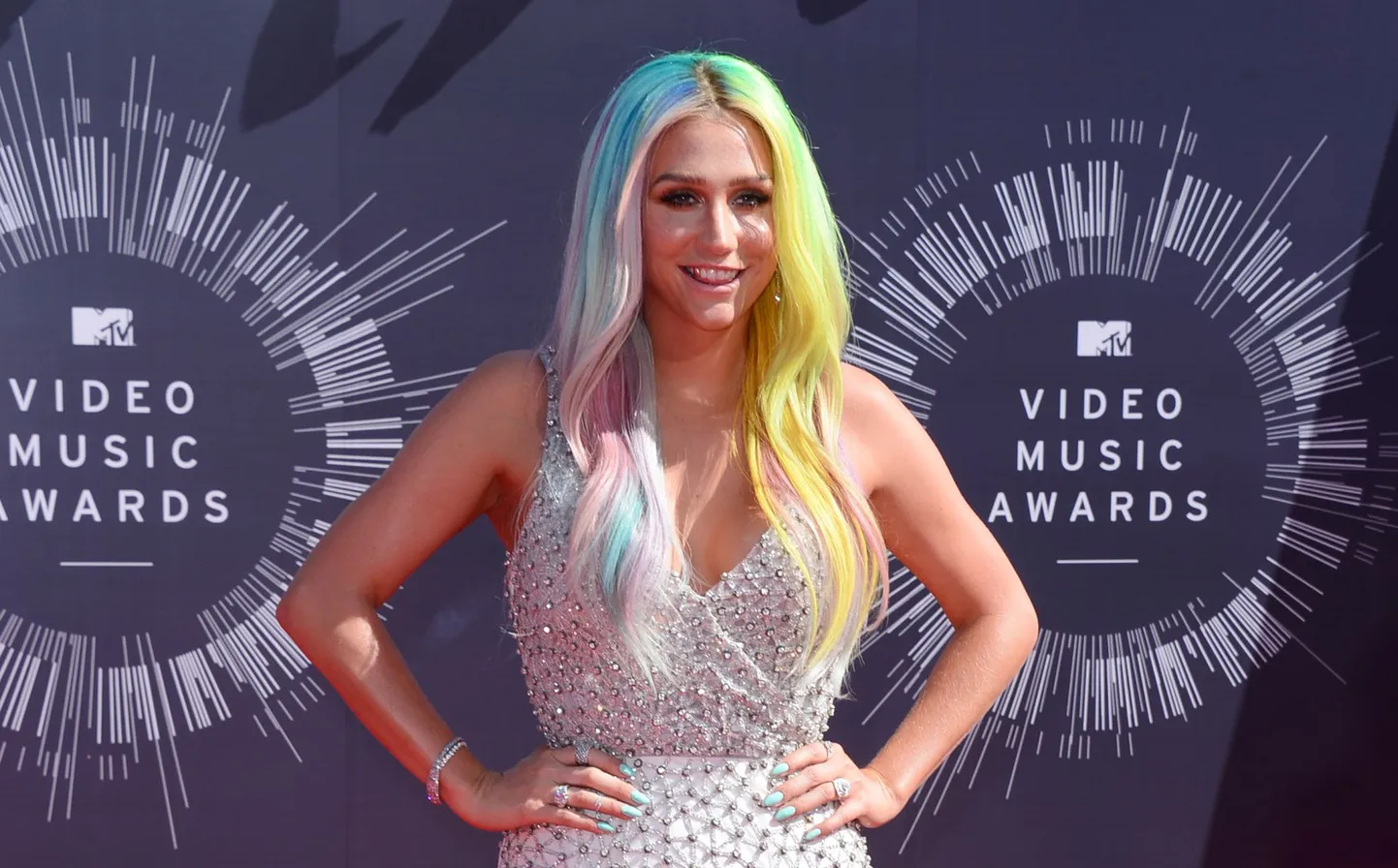 Kesha.