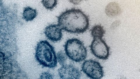 AFP: новый коронавирус унес по всему миру более 35 000 жизней