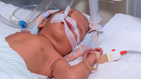 Коронавирус у детей: в Эстонии заразился новорожденный, восьмимесячный нуждался в ИВЛ