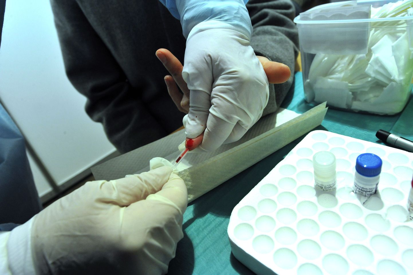 Tartu Ülikooli vilistlased püüavad luua uut suguhaiguste kiirtesti. Pildil juba olemasoleva HIV-kiirtesti tegemine.