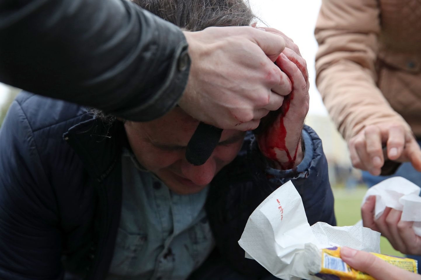Minsk, Valgevenemaa, 11.oktoober. Vigastatud mees saab esmaabi protesti ajal.
