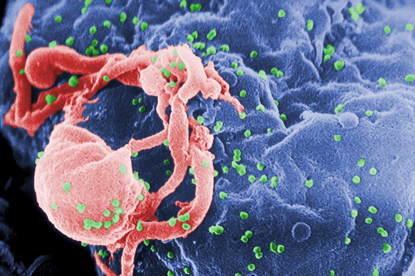 HIV vīruss. Ilustratīvs attēls