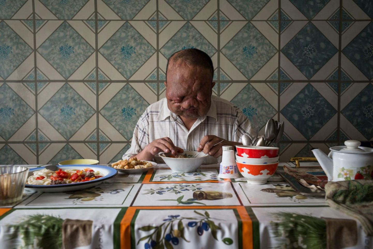 Berik Syzdykov elab Semej linnas Kashastani kirdeosas, mis asub ligikaudu 150 kilomeetri kaugusel kunagisest Semipalatinski testimispaigast. Mees on pime ja läbinud elu jooksul mitu operatsiooni, millega on püütud vähendada paistetust tema näol.