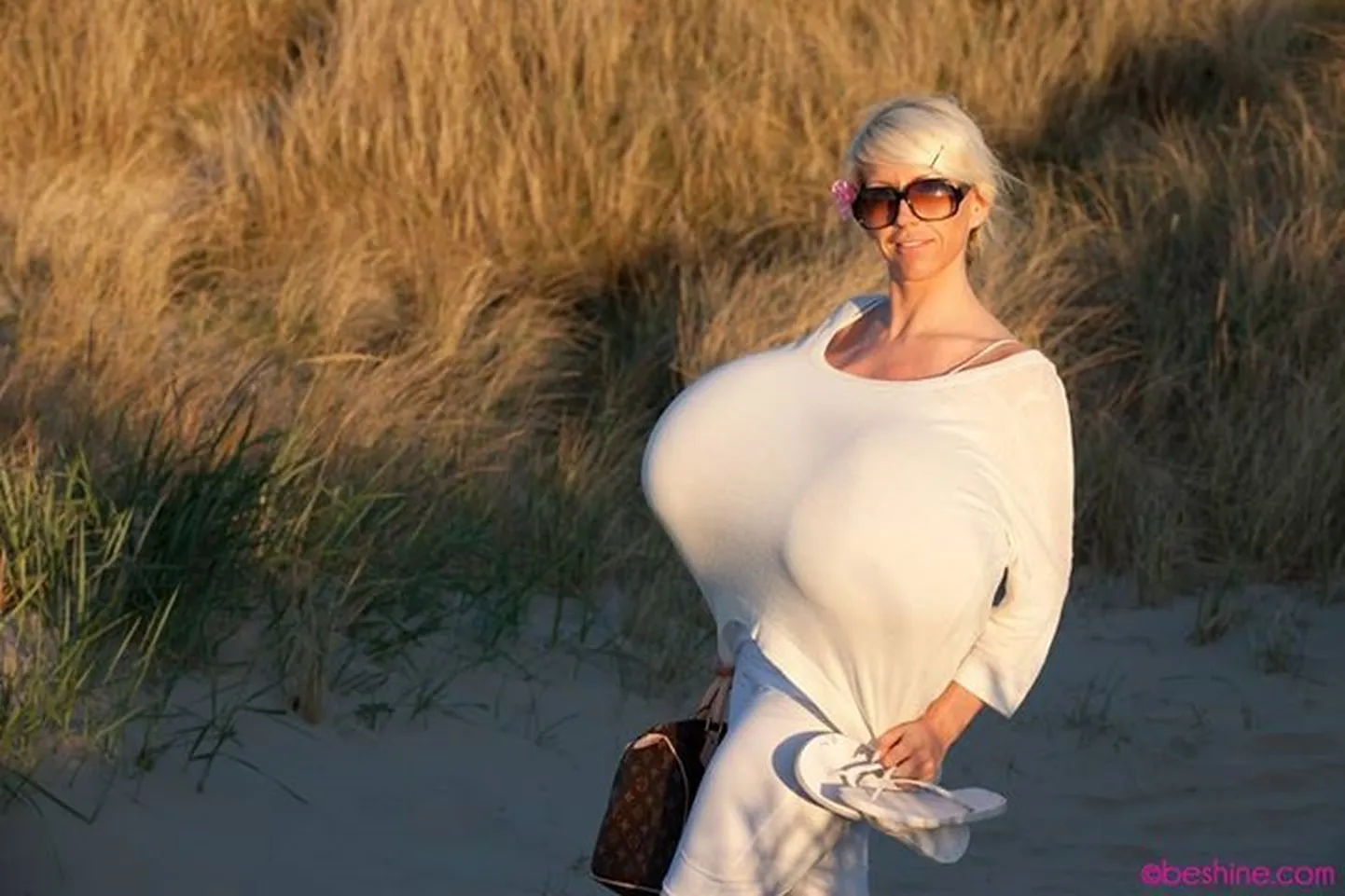 Beshine 18 kilosed rinnaimplantaadid on maailma suurimad