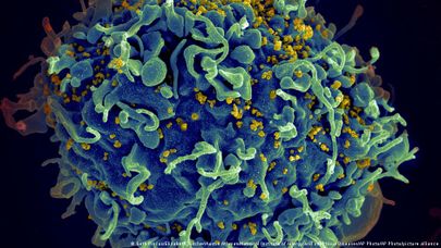 Так под микроскопом выглядит вирус иммунодецифита человека