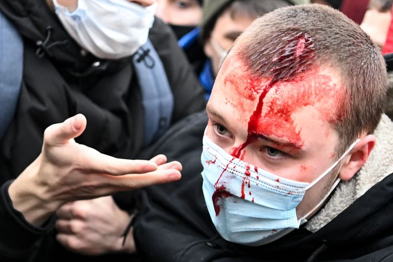 Участник шествия в поддержку арестованного лидера оппозиции Алексея Навального. Москва, 23 января 2021.