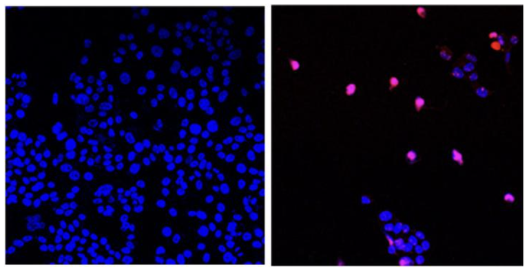 На изображении показаны необработанные раковые клетки (слева) и обработанные AOH1996 раковые клетки (справа), запрограммированные на гибель (фиолетовые).