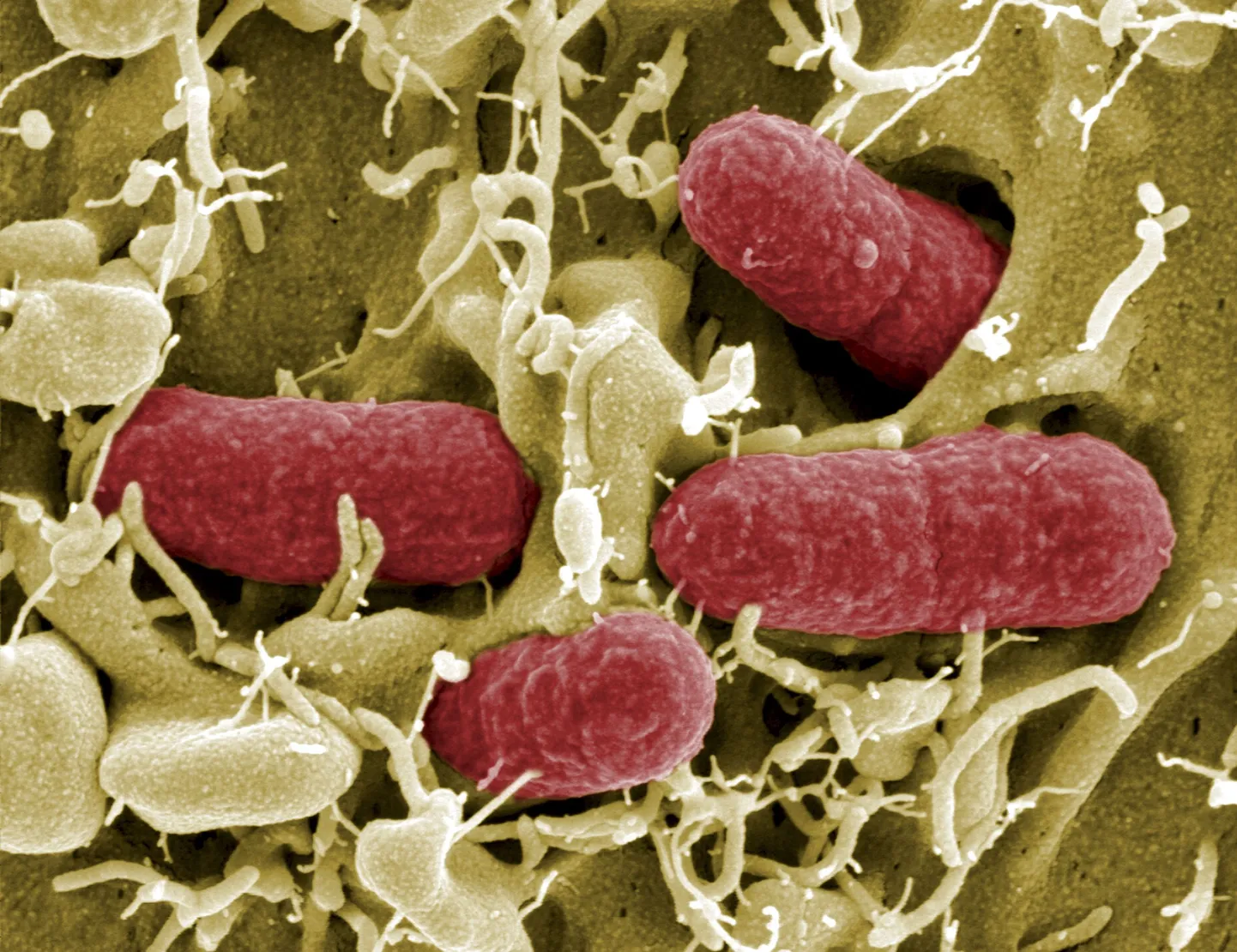 Enterohaemorrhagic Escherichia Coli