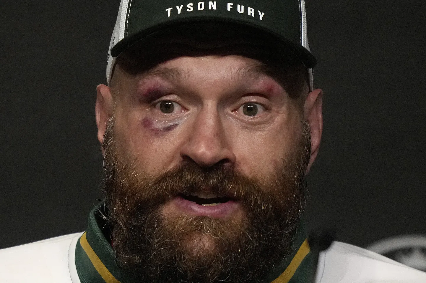Taisons Fjūrijs.
