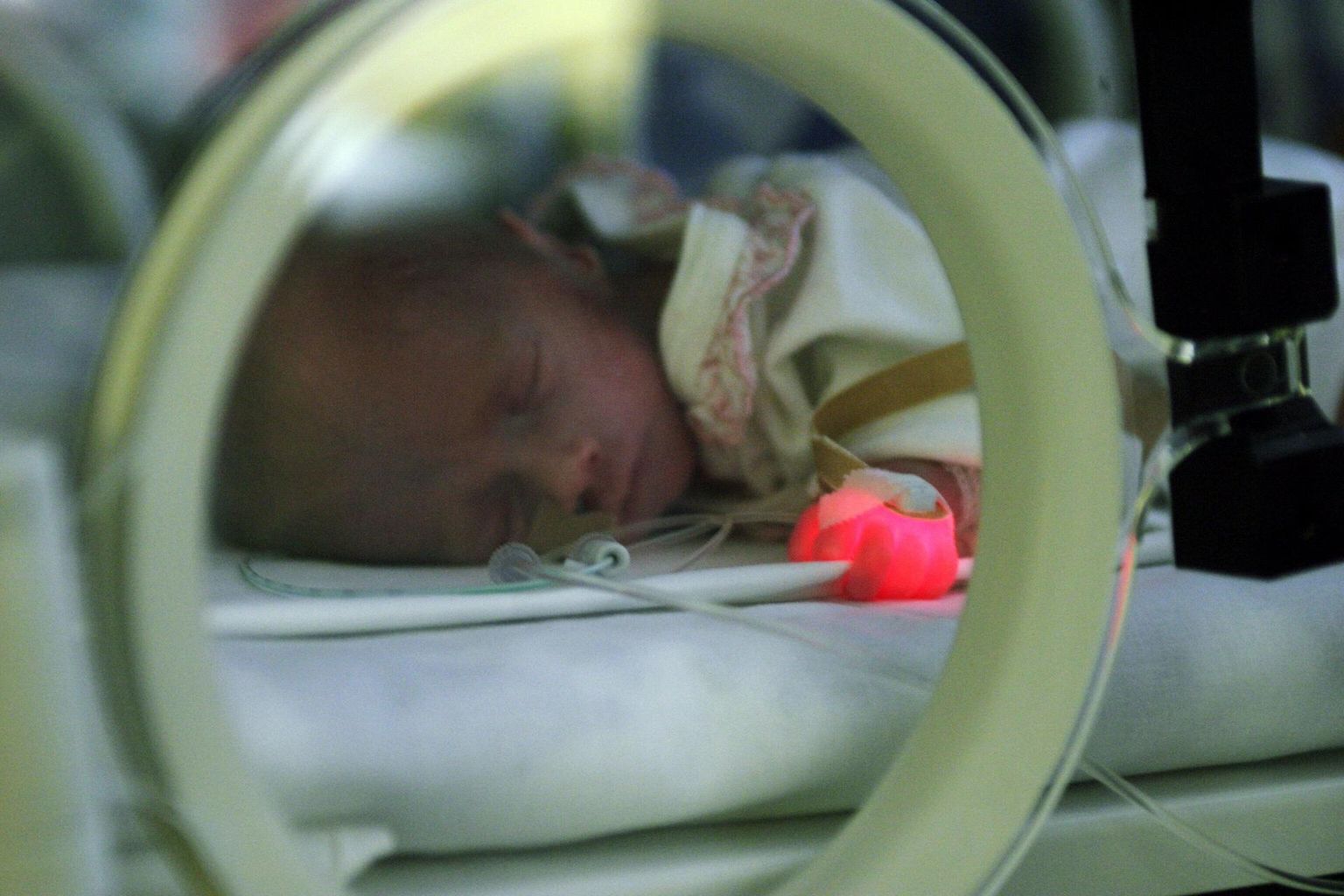 Недоношенный ребенок в реанимационном отделении детской поликлиники Клиникума Тартуского университета.