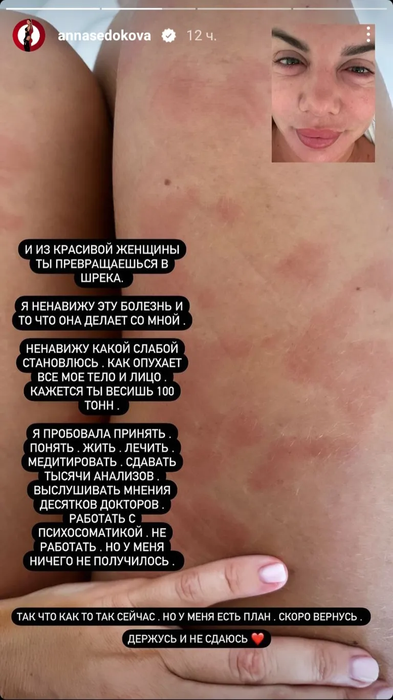 Фото статьи
