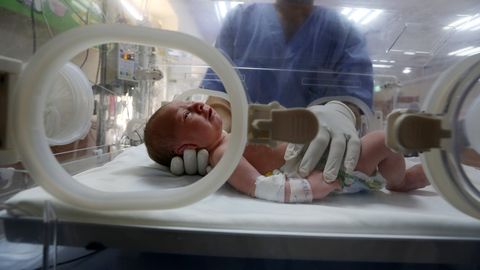 Gaza arstid päästsid Iisraeli õhurünnakus hukkunud ema üsast sündimata lapse